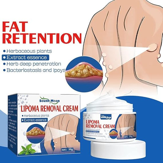 South Moon Lipoma Removal Cream || RAMADAN SALE OFFER